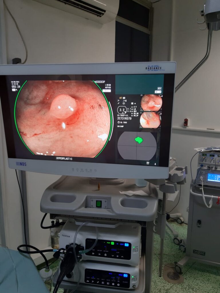 GASTROCENTRO recebe demonstração  de novo equipamento na detecção do câncer  precoce