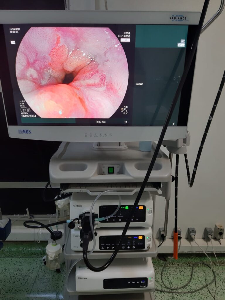 GASTROCENTRO recebe demonstração de novo equipamento na detecção do câncer precoce